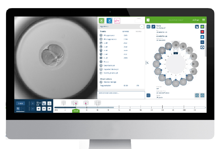 �r(sh��)�����B(y��ng)��