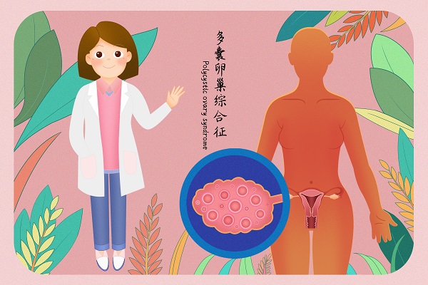 女性不孕,多囊卵巢綜合征,多囊卵巢綜合征不孕